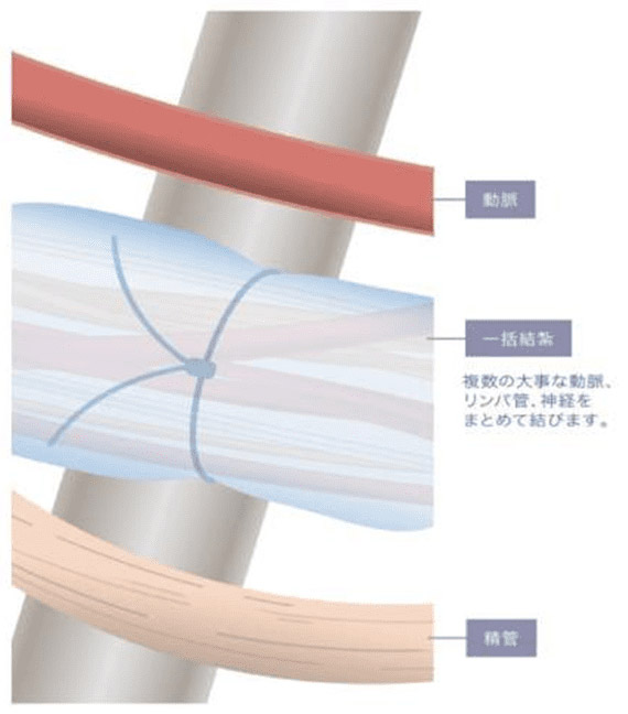 一般的に行われている手術